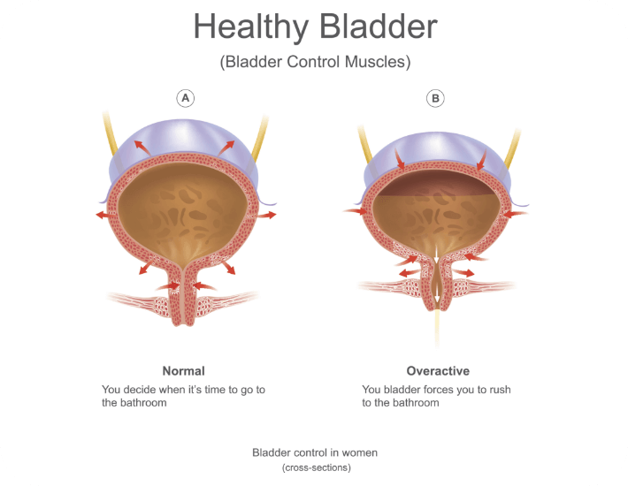 Healthy Bladder