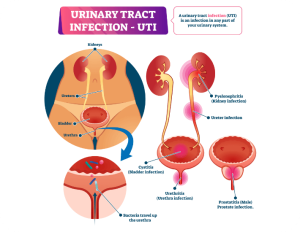 Urinary Tract Infections (UTIs) - Synergy Urology