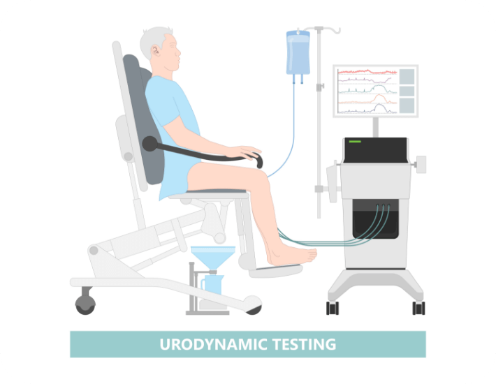 Urofynamic